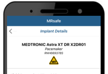 Screenshot of the Implant Screen.